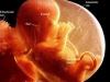 12 week fetus 3D ultrasound at Living Images near Fort Walton Beach and Shalimar