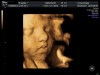 30 week 4D ultrasound baby image at Living Images in Shalimar Florida