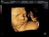 3D ultrasound baby face at Living Images in Shalimar near Fort Walton Beach