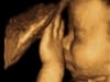 Baby 4D ultrasound gallery image at Living Images in Shalimar Florida