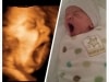 Baby yawn 3D ultrasound at Living Images near Fort Walton Beach