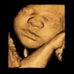 Meet Me Package ultrasound image in Shalimar Fort Walton Beach
